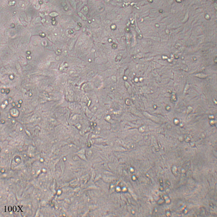 HCT-15 人结直肠腺癌上皮细胞