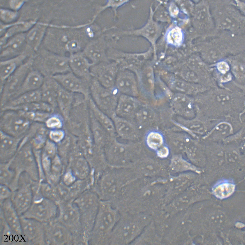 143B 人骨肉瘤细胞