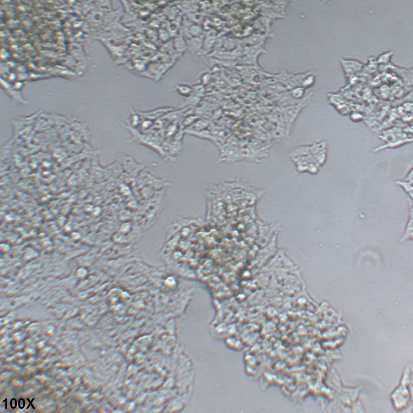 HepG2.2.15 表达HBV病毒的人肝癌细胞
