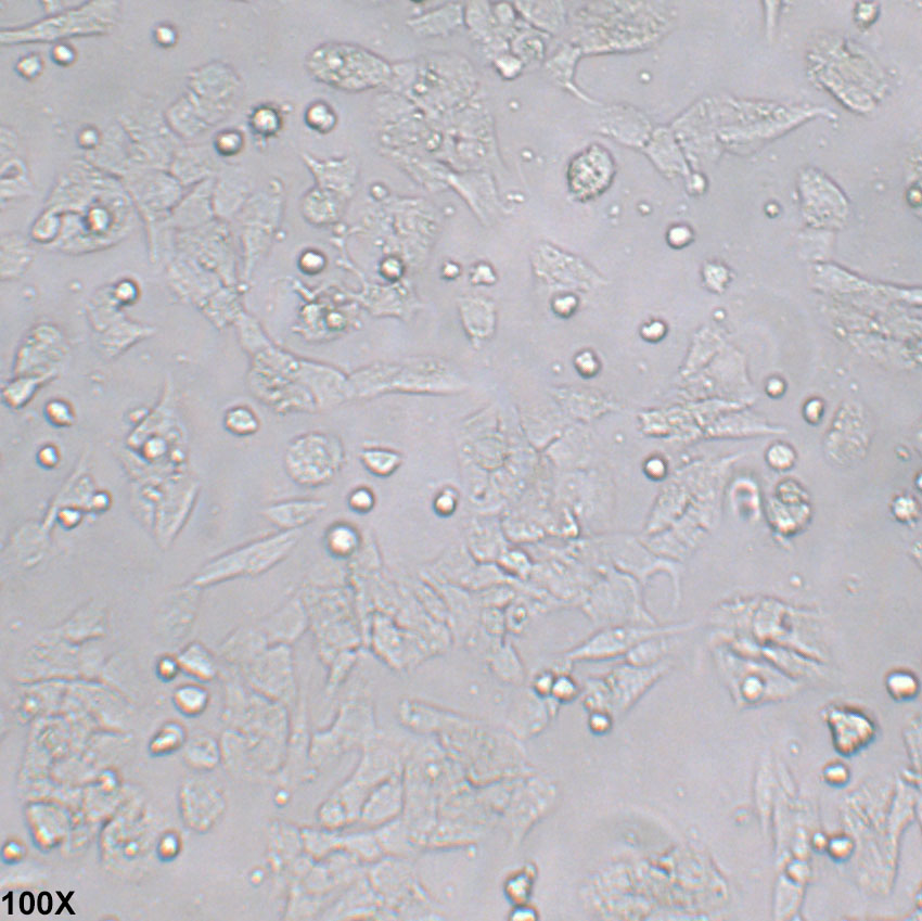 A-673 人横纹肌肉瘤细胞