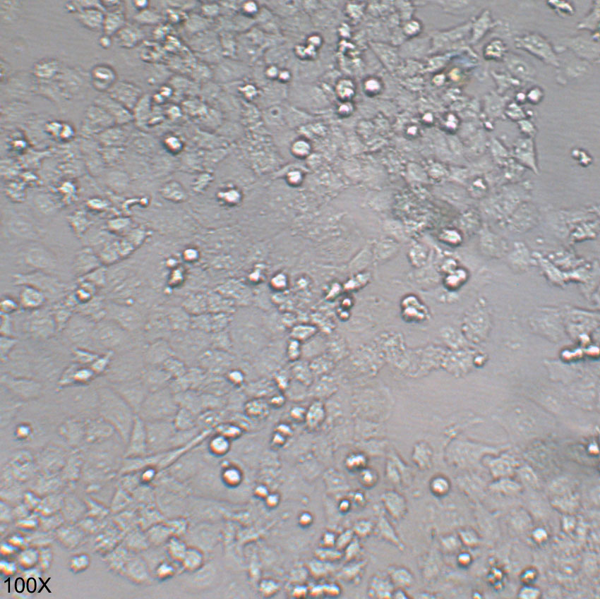 NCI-H23 人非小细胞肺癌细胞