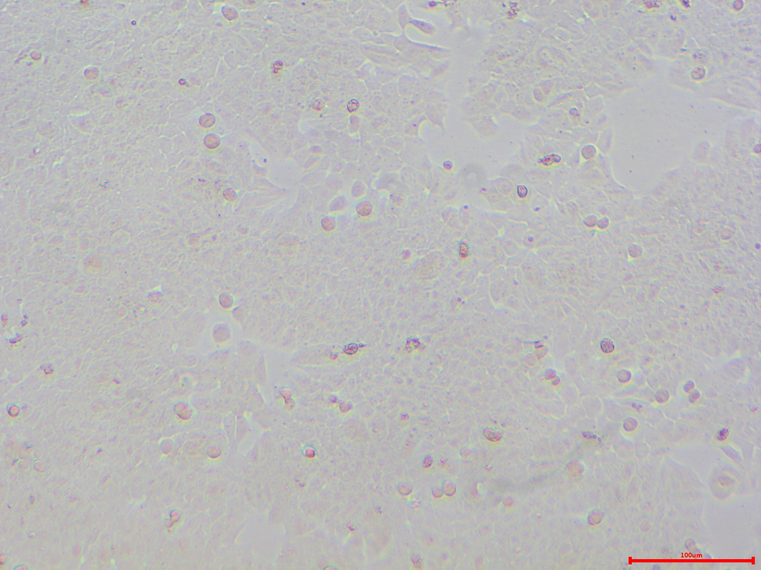 MDA-MB-361 人乳腺癌细胞