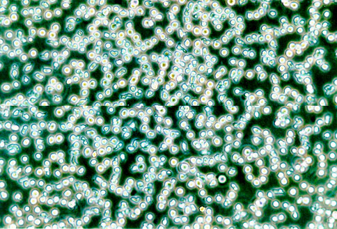 BALL-1 人B淋巴细胞急性白血病细胞