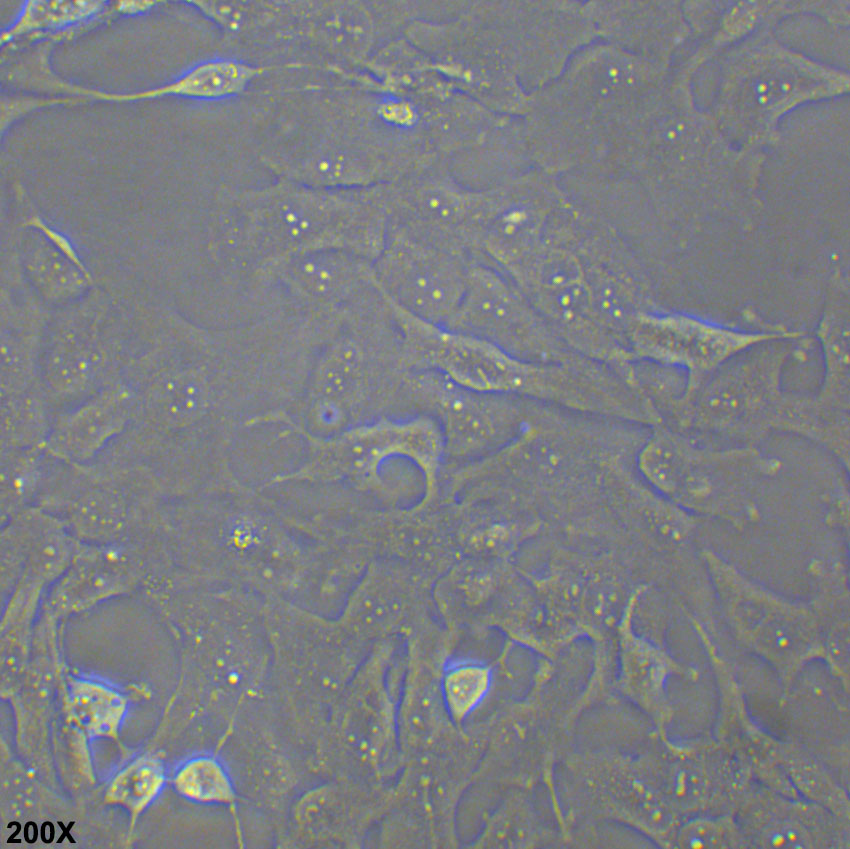 B-CPAP 人甲状腺癌细胞（乳头状）