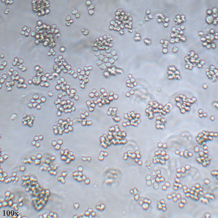 Namalwa 人Burkitt's淋巴瘤细胞