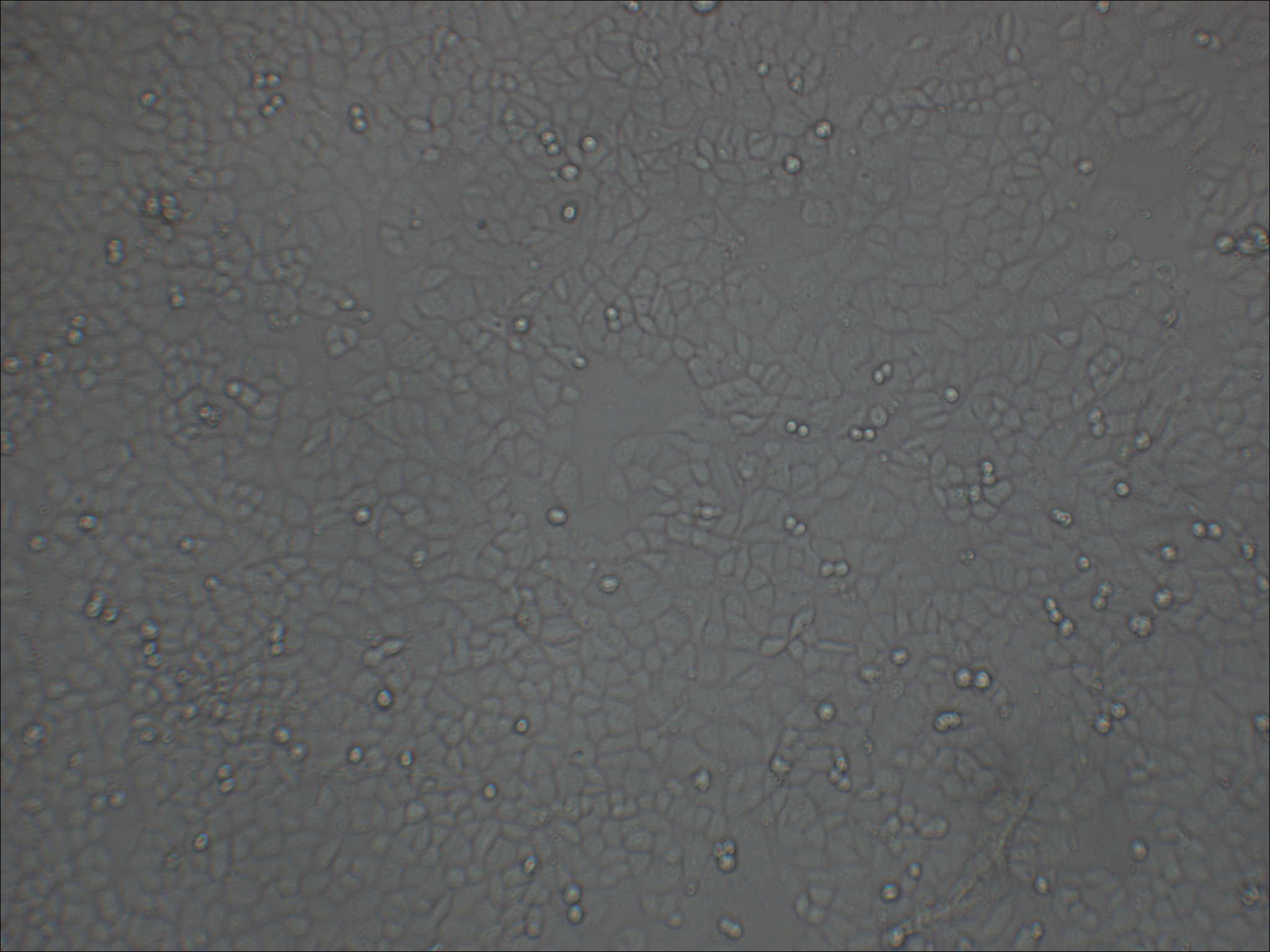 MDA-MB-468 人乳腺癌细胞