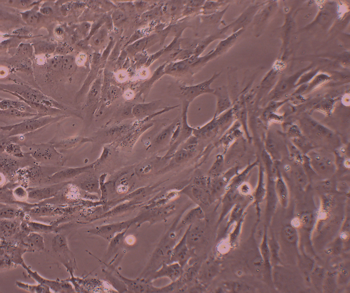 hFOB 1.19 SV40转染人成骨细胞