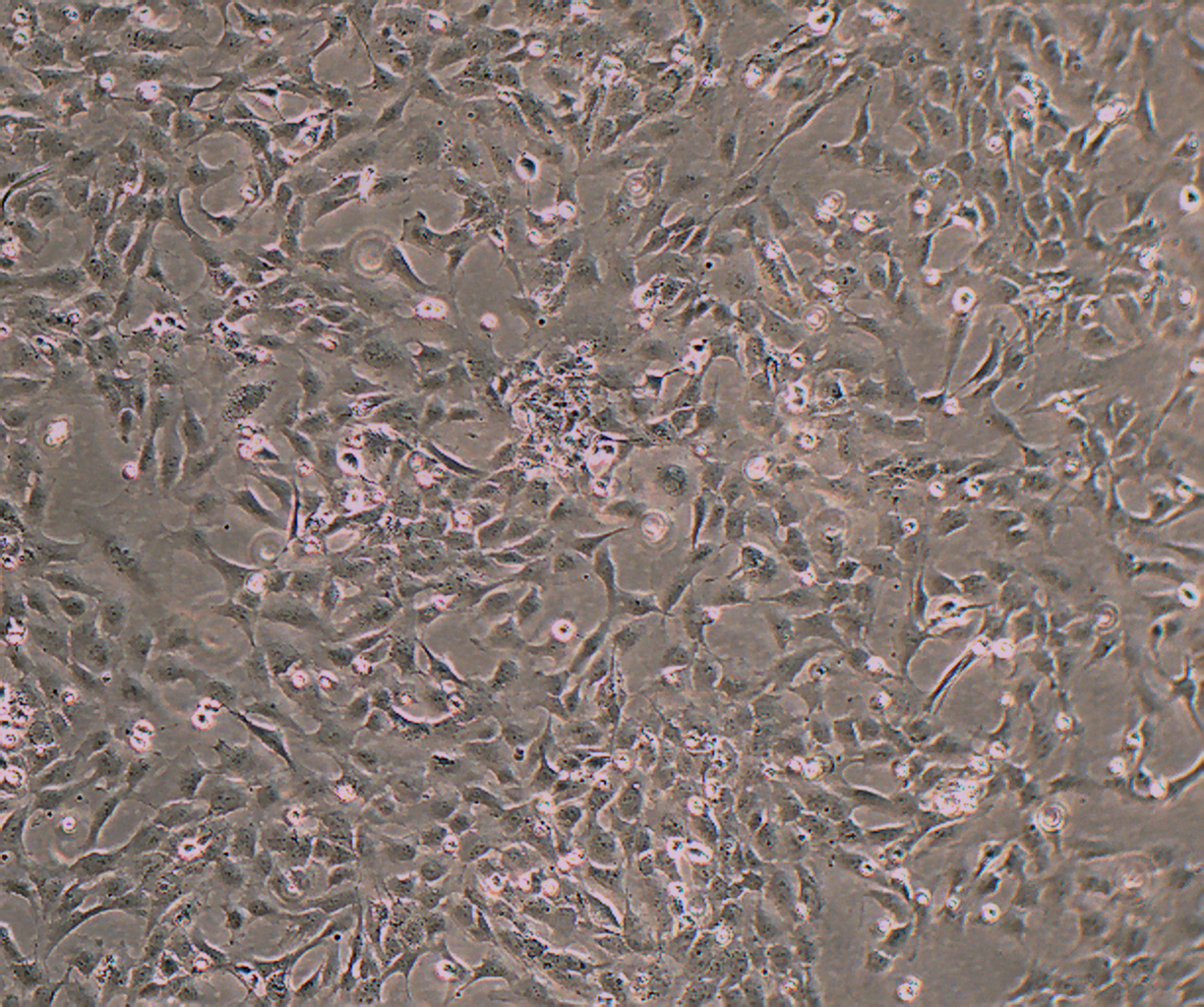 HUVEC-T1 人脐静脉内皮细胞