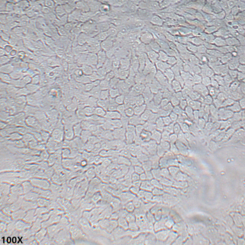 Bxpc-3 人原位胰腺癌细胞（中等至未分化）
