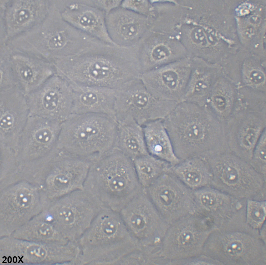 NCI-H226 人间皮瘤细胞