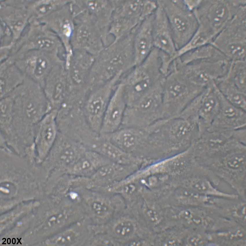 A-875 人黑色素瘤细胞
