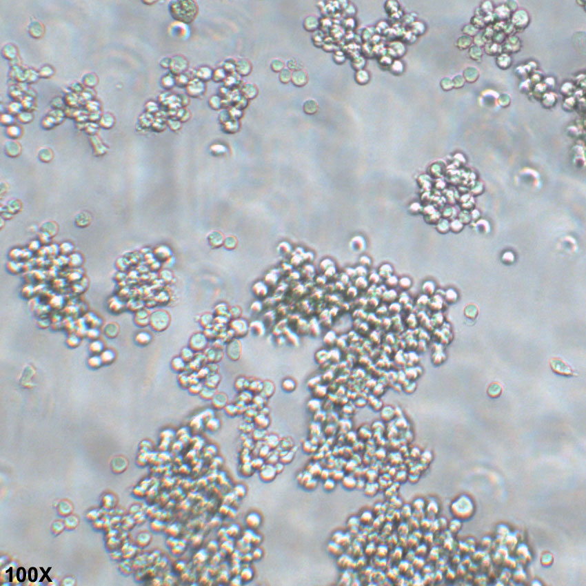 HEL 人红白细胞白血病细胞