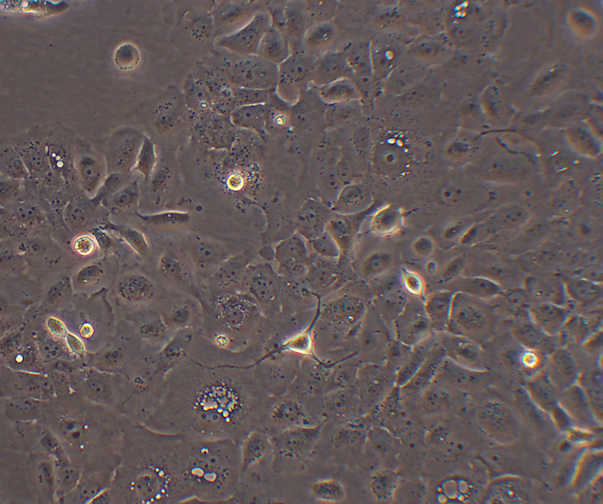 SW1990 人胰腺癌细胞（二级腺癌）