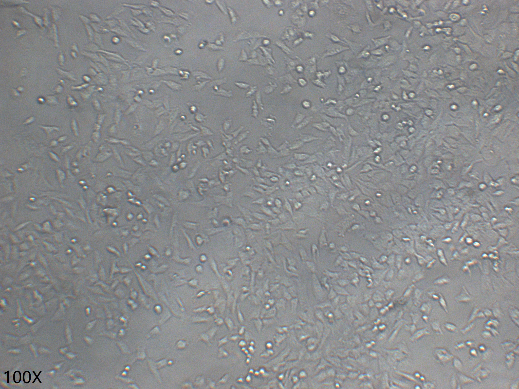 NCI-H1703 人肺鳞癌细胞