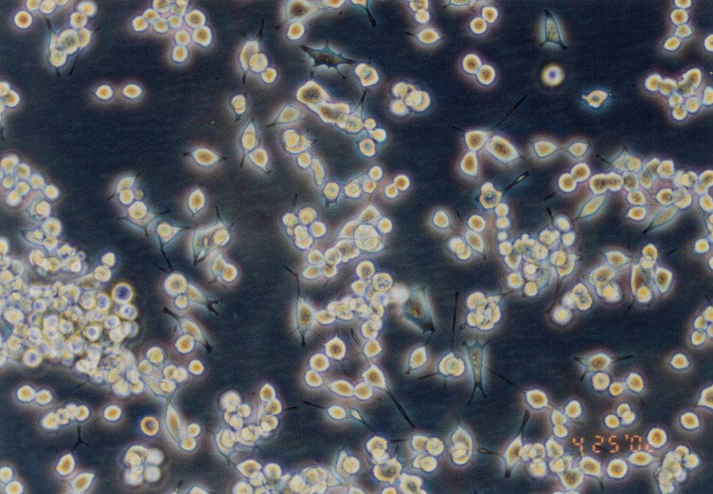 RAG 小鼠肾腺癌细胞