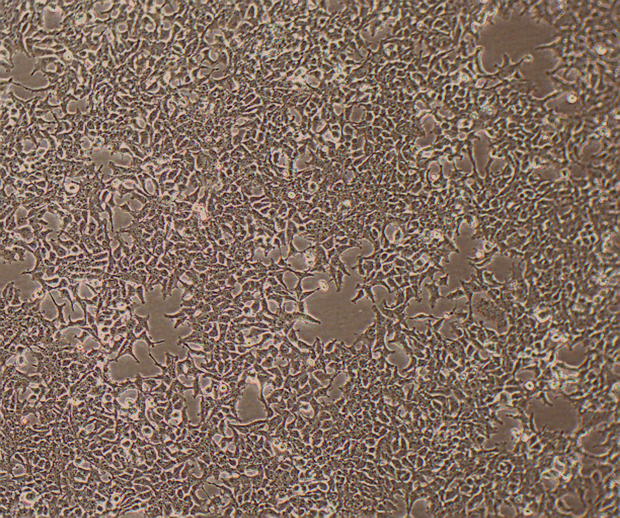 293T SV40T转化的人胚肾细胞