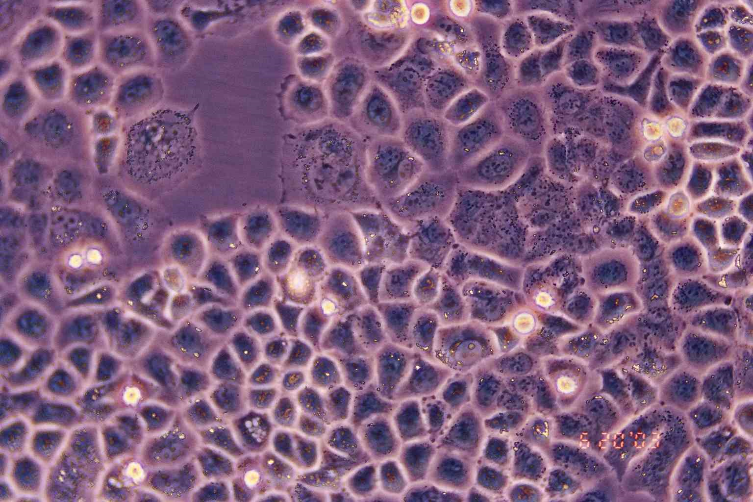 SW-13 人肾上腺皮质小细胞癌细胞