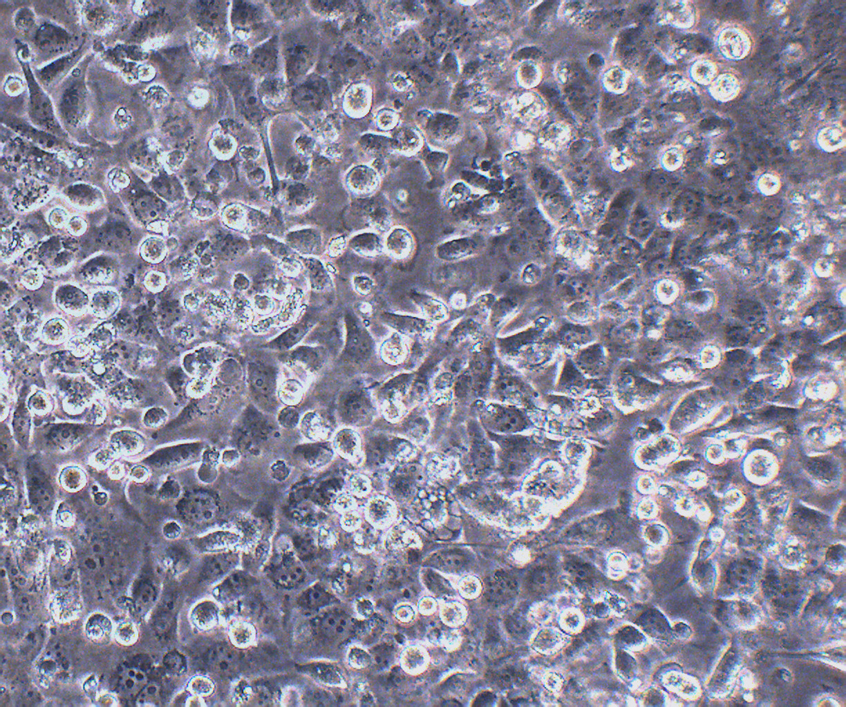 JIMT-1 人乳腺癌细胞