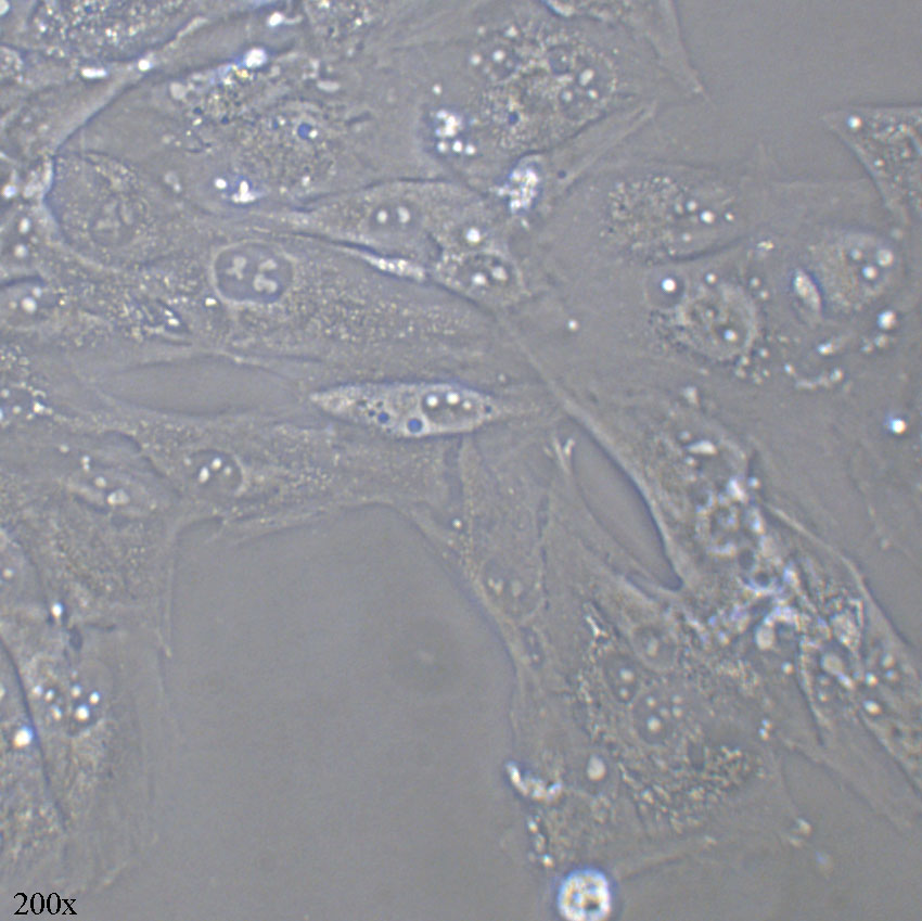 Caki-1 人肾透明细胞癌皮肤转移细胞