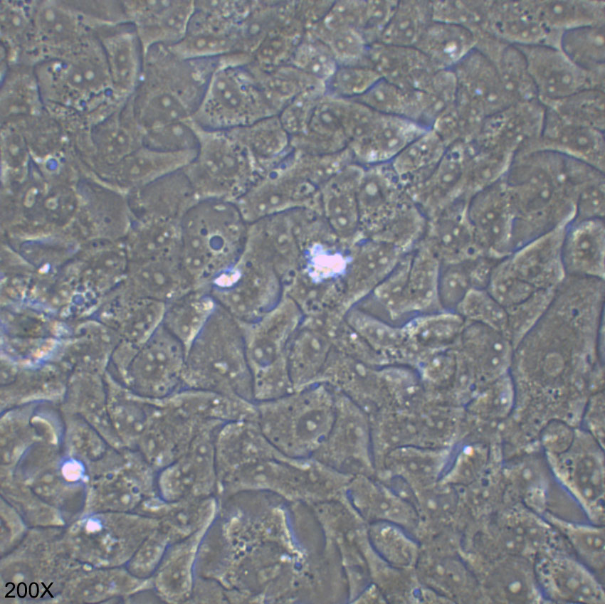 HCC4006 人肺癌腺癌细胞