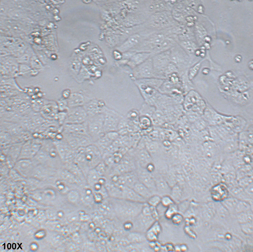 Huh-6 人肝母细胞瘤细胞