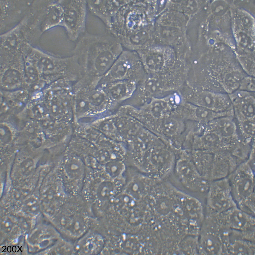 BHT-101 人甲状腺癌细胞（退行性）