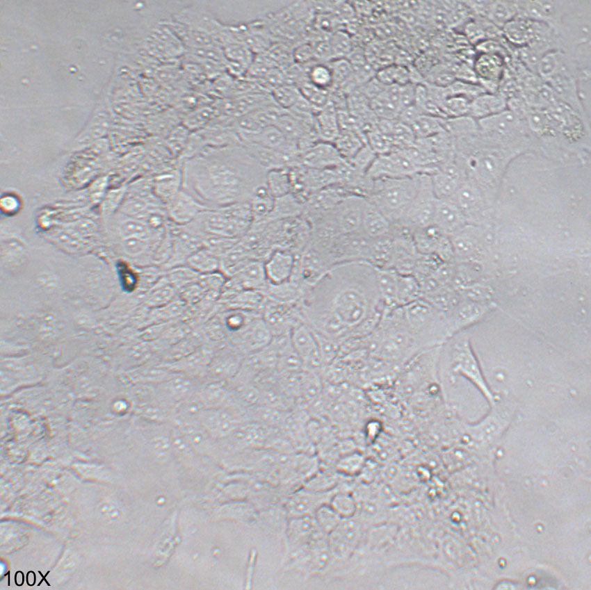 HCC827 人非小细胞肺癌细胞