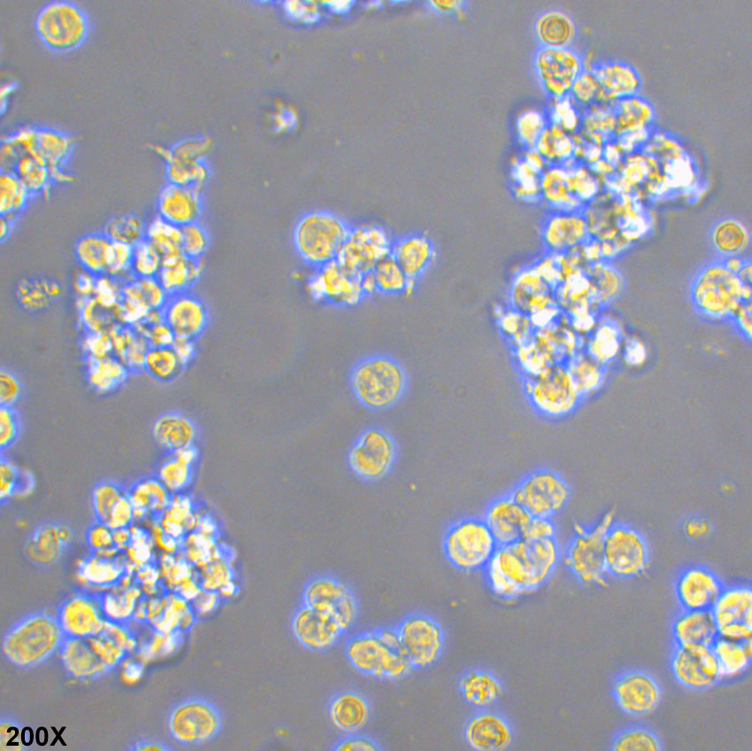 HuT 78 人T淋巴细胞白血病细胞