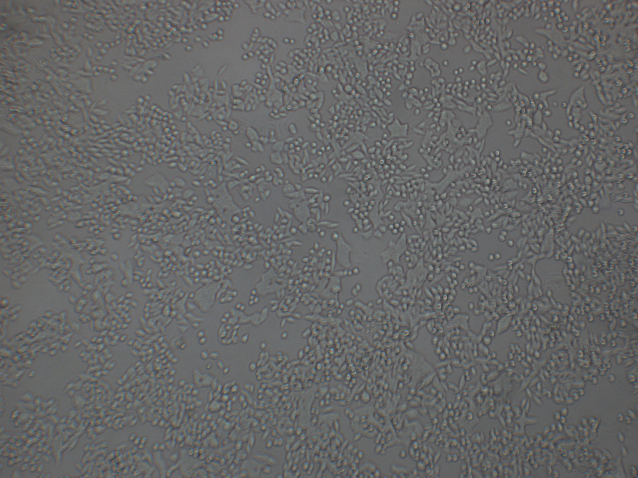 SW620 人结肠癌细胞