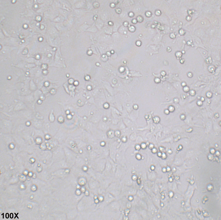 PA-1 人卵巢畸胎瘤细胞