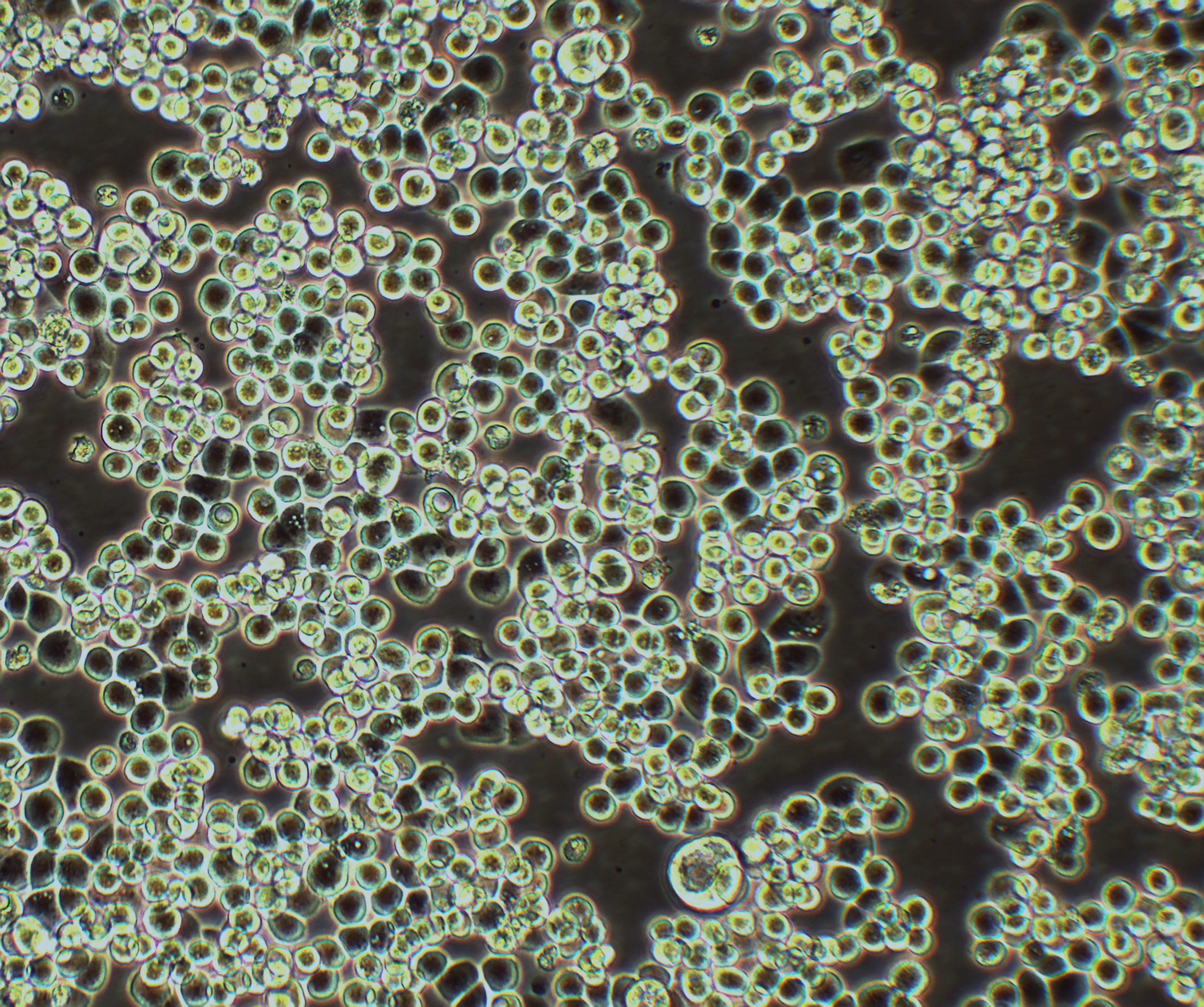 MDA-MB-453 人乳腺癌细胞