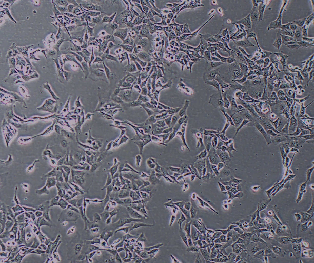 HCCC-9810 人胆管细胞型肝癌细胞