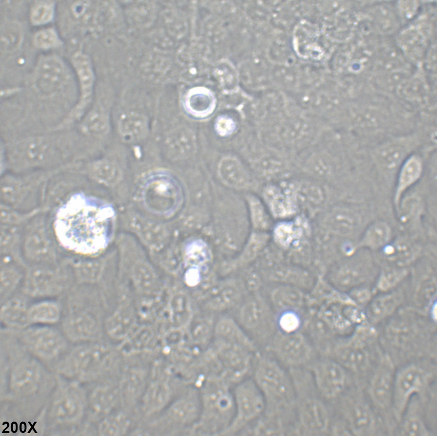 SW626 人结肠腺癌细胞(卵巢转移)