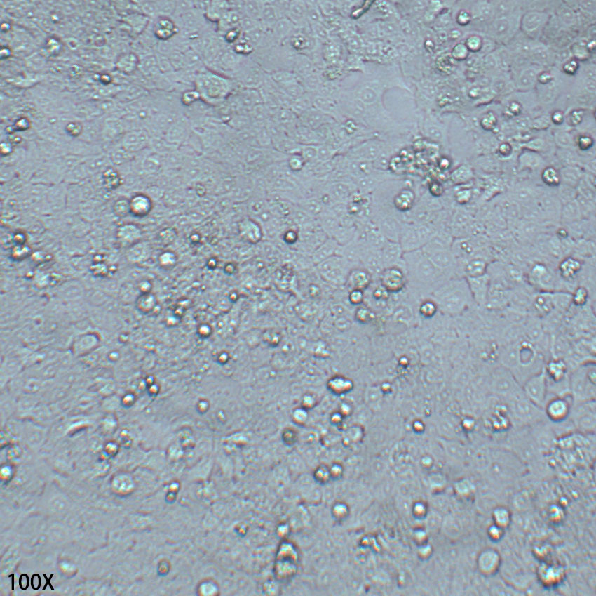 NCI-H1573 人非小细胞肺腺癌细胞