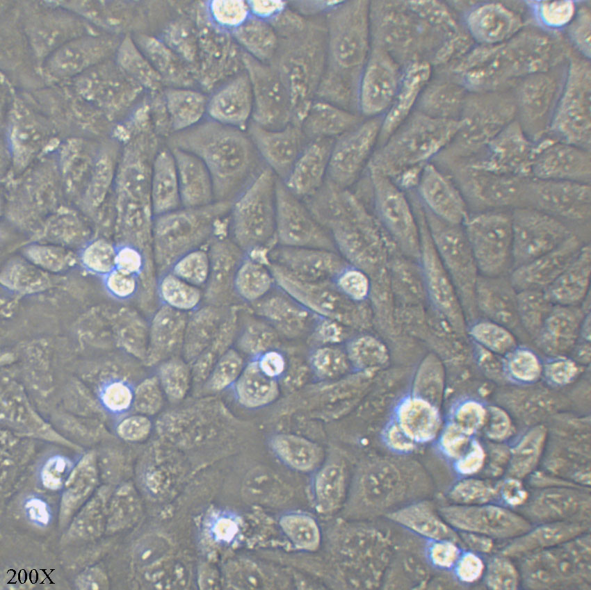 T24 人膀胱移行细胞癌细胞