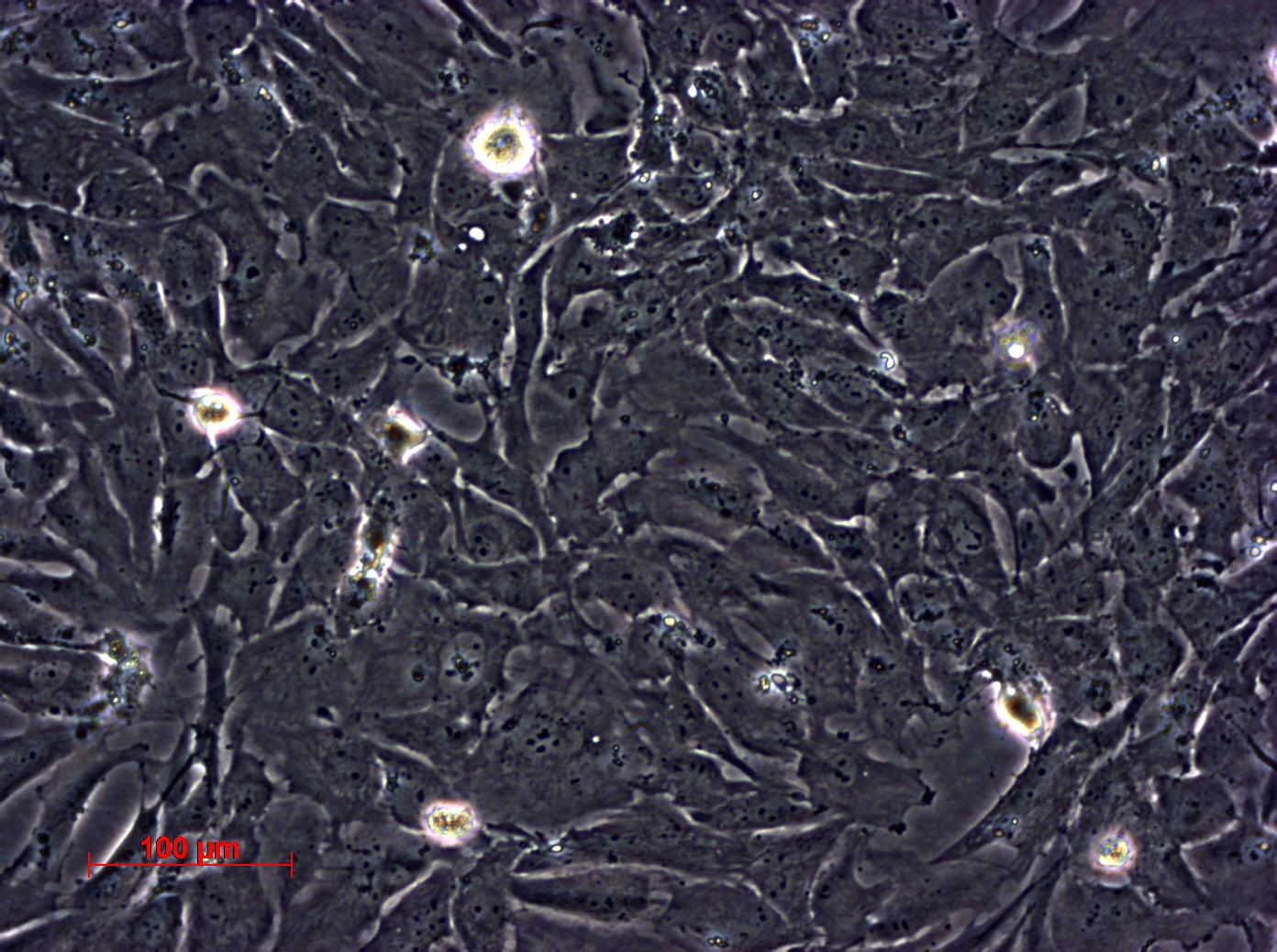 HS 578T 人乳腺癌细胞