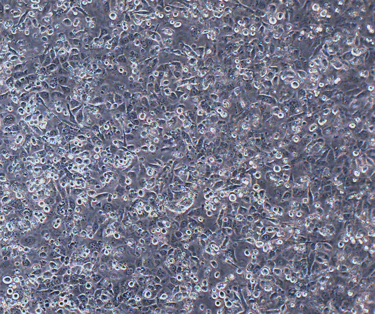 JIMT-1 人乳腺癌细胞