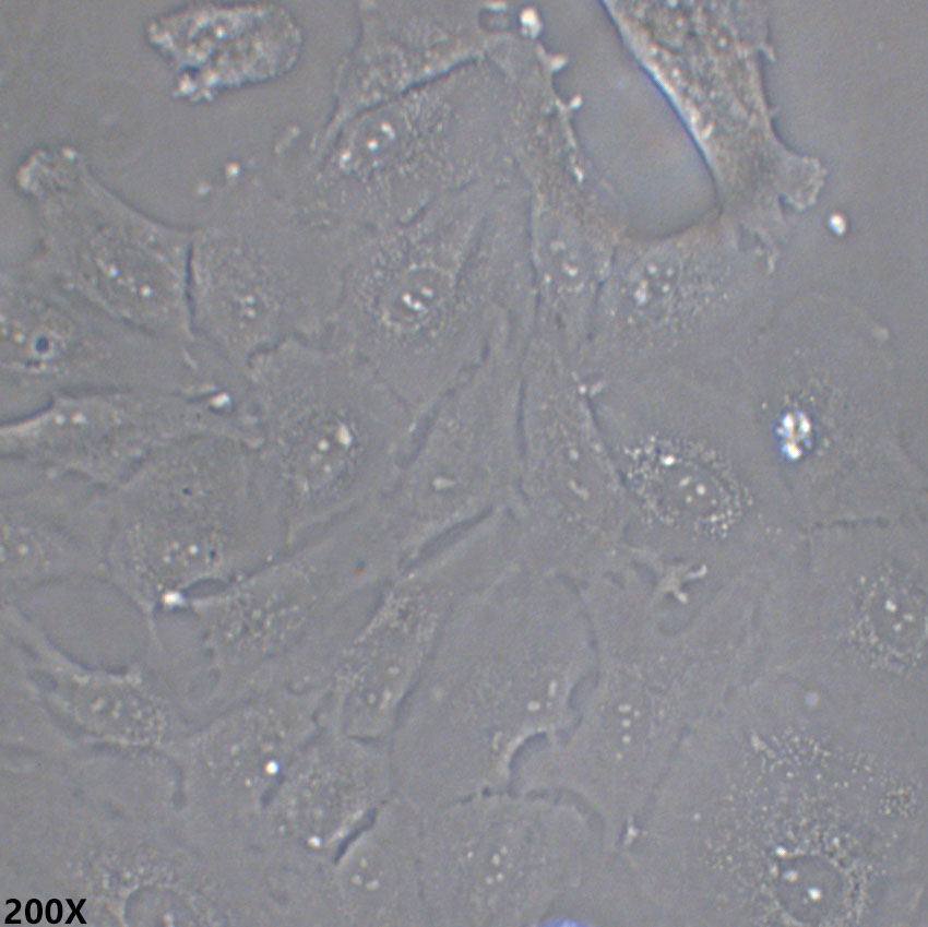 COV504 人卵巢上皮浆液性癌细胞