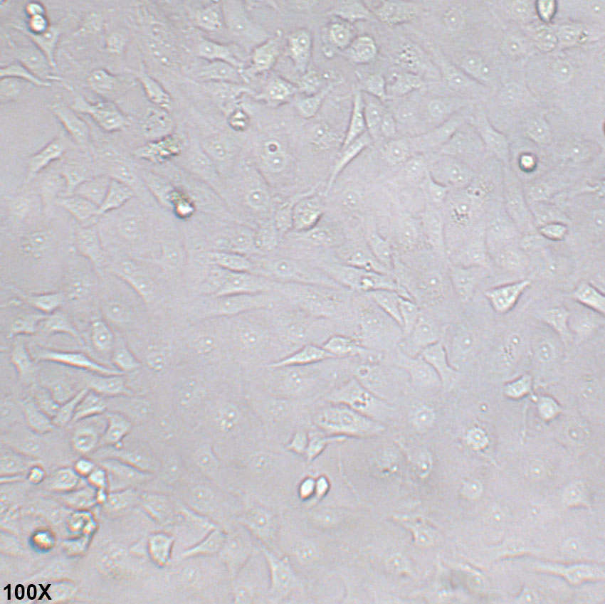 MDA-MB-157 人乳腺癌细胞