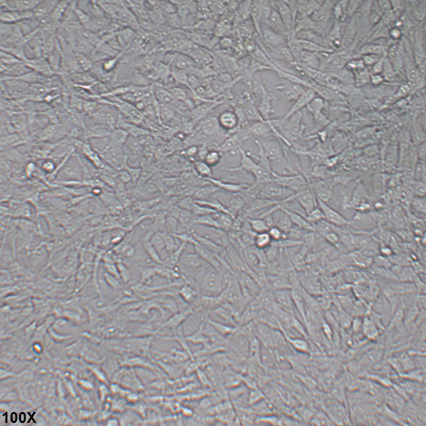 ES-2 人卵巢透明细胞癌细胞