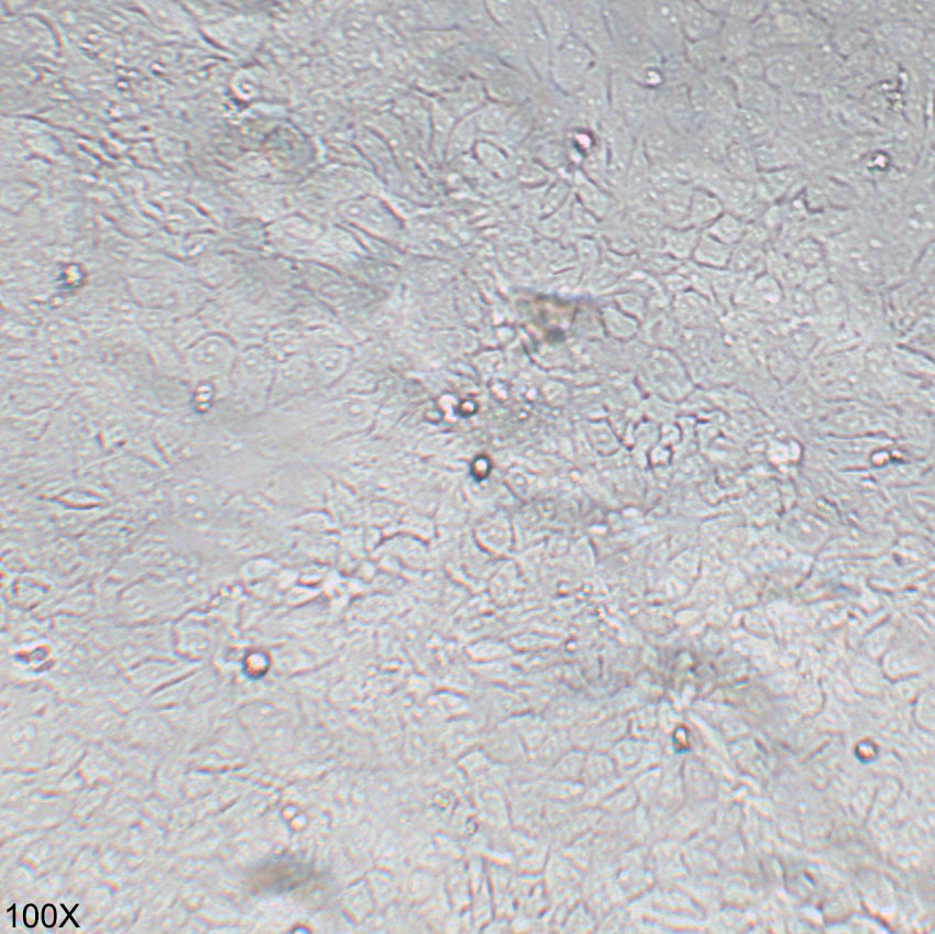 HCT-8 人结直肠腺癌细胞