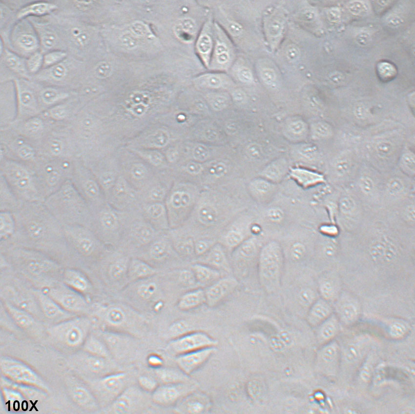 NCI-H226 人间皮瘤细胞