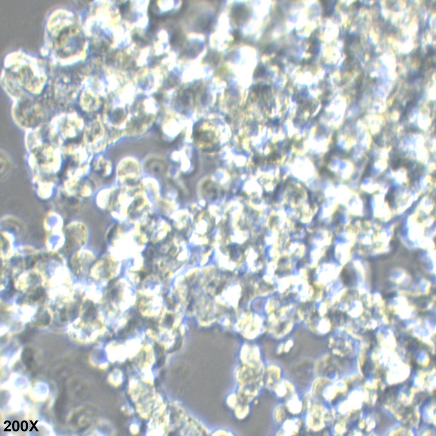 NCI-H526 人肺癌转移