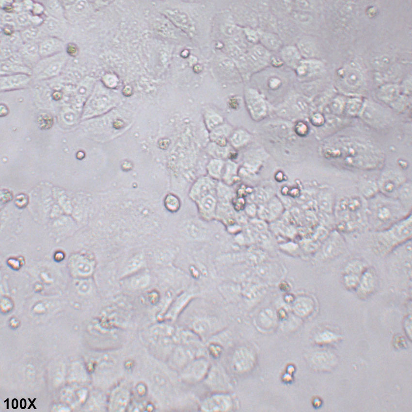 NCI-H460 人大细胞肺癌细胞