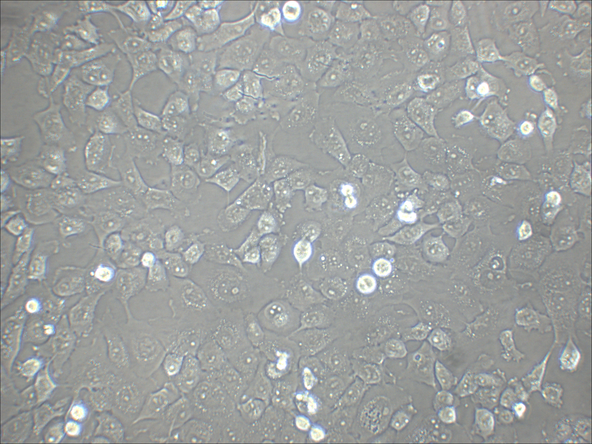 NCI-H1299 人非小细胞肺癌细胞