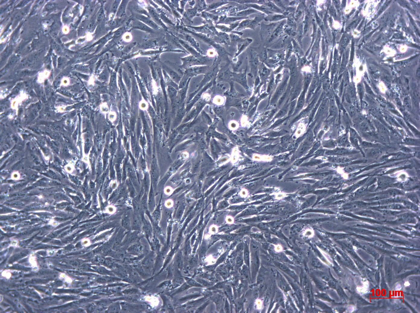HS683 人脑胶质瘤细胞