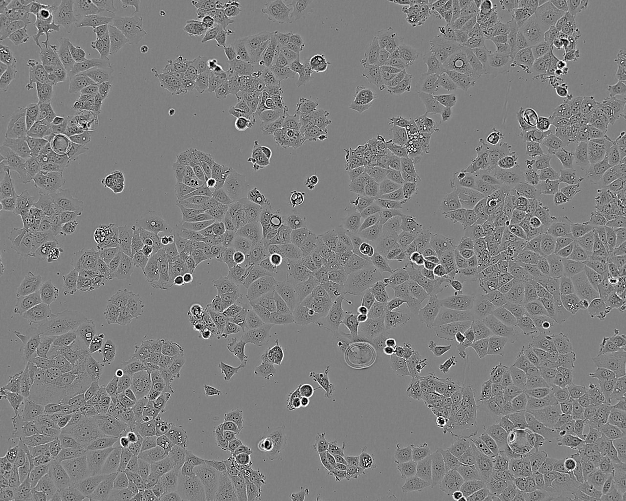 MCF7 人乳腺癌细胞