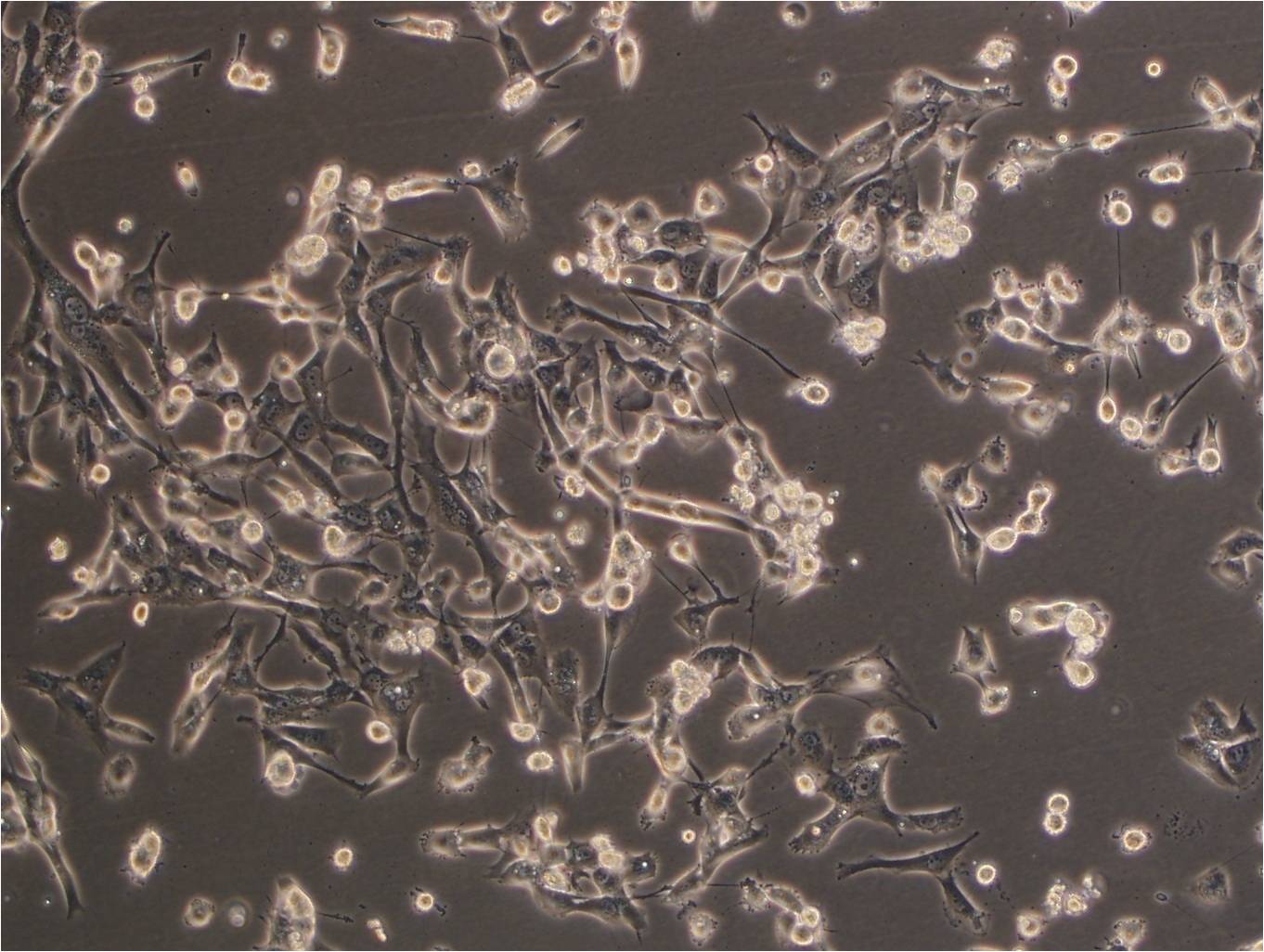 BT-549 人乳腺导管癌细胞
