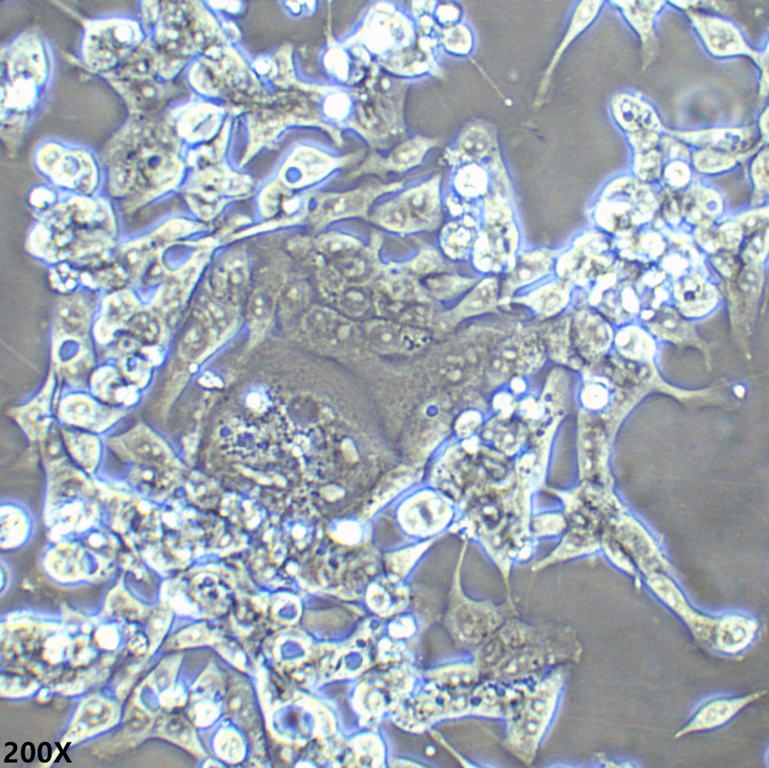 LoVo 人结肠癌细胞