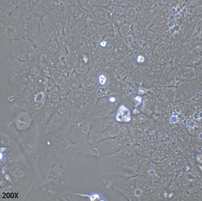 Ishikawa 人子宫内膜癌细胞